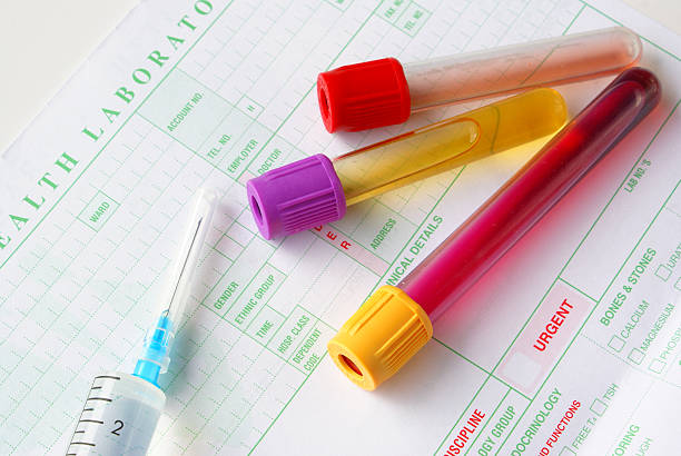 Blood Collection Tubes