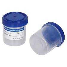 URINE CONTAINER BULK PACK 30ML -100PC
